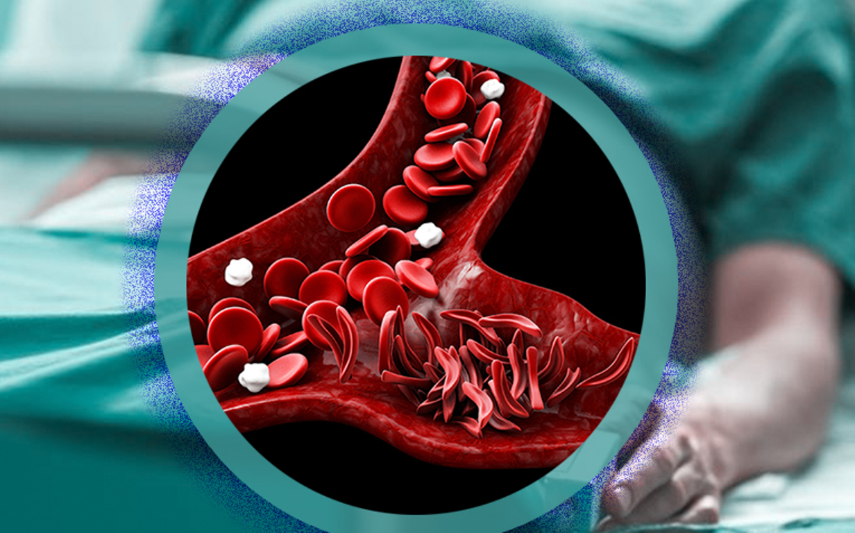 कर्णालीका सिकलसेलका विरामीलाई लुम्बिनी धाउनुपर्ने बाध्यता
